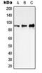 Signal Transducer And Activator Of Transcription 1 antibody, MBS8219182, MyBioSource, Western Blot image 