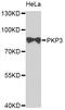 Plakophilin 3 antibody, abx127009, Abbexa, Western Blot image 