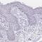 Cingulin-like protein 1 antibody, PA5-63366, Invitrogen Antibodies, Immunohistochemistry frozen image 