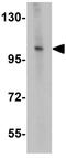 Zinc Finger Protein 281 antibody, GTX31830, GeneTex, Western Blot image 