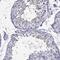 Cholinergic Receptor Nicotinic Beta 3 Subunit antibody, NBP1-91783, Novus Biologicals, Immunohistochemistry paraffin image 