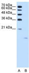 Acid Phosphatase antibody, TA346376, Origene, Western Blot image 