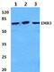 Adhesion G Protein-Coupled Receptor E3 antibody, PA5-75324, Invitrogen Antibodies, Western Blot image 