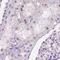 NHP2 Ribonucleoprotein antibody, PA5-60638, Invitrogen Antibodies, Immunohistochemistry paraffin image 