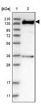 Ankyrin repeat and IBR domain-containing protein 1 antibody, NBP2-47548, Novus Biologicals, Western Blot image 