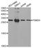 Proteasome 26S Subunit, Non-ATPase 9 antibody, TA332635, Origene, Western Blot image 