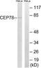 Centrosomal Protein 78 antibody, TA315897, Origene, Western Blot image 