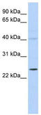 Potassium Voltage-Gated Channel Interacting Protein 2 antibody, TA338770, Origene, Western Blot image 