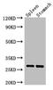Chymotrypsinogen B1 antibody, A58690-100, Epigentek, Western Blot image 