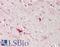 Heparanase 2 (Inactive) antibody, LS-B14593, Lifespan Biosciences, Immunohistochemistry paraffin image 