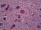 Oligodendrocyte Transcription Factor 2 antibody, 51-906, ProSci, Immunohistochemistry paraffin image 