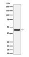 Nodal Growth Differentiation Factor antibody, M07627, Boster Biological Technology, Western Blot image 