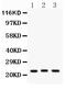 Peroxiredoxin 5 antibody, PB9384, Boster Biological Technology, Western Blot image 