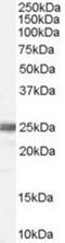 Ribosomal Protein L19 antibody, NB100-41376, Novus Biologicals, Western Blot image 