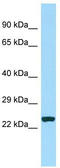 Cell division cycle-associated protein 7 antibody, TA331381, Origene, Western Blot image 