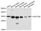 Hydroxysteroid 17-Beta Dehydrogenase 8 antibody, STJ114813, St John