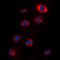 Ribosomal Protein S12 antibody, LS-C368689, Lifespan Biosciences, Immunofluorescence image 
