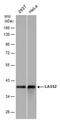 Ceramide Synthase 2 antibody, PA5-78486, Invitrogen Antibodies, Western Blot image 