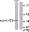 Ephrin B3 antibody, LS-C118439, Lifespan Biosciences, Western Blot image 