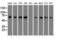 Aryl Hydrocarbon Receptor Nuclear Translocator Like antibody, GTX84851, GeneTex, Western Blot image 