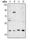 Nei Like DNA Glycosylase 1 antibody, LS-C760949, Lifespan Biosciences, Western Blot image 