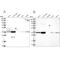 G-Patch Domain Containing 11 antibody, NBP1-93801, Novus Biologicals, Western Blot image 