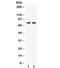 MDM4 Regulator Of P53 antibody, R31805, NSJ Bioreagents, Western Blot image 