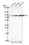 Spindle And Kinetochore Associated Complex Subunit 1 antibody, NBP1-92391, Novus Biologicals, Western Blot image 