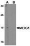 Meiosis/Spermiogenesis Associated 1 antibody, A16264, Boster Biological Technology, Western Blot image 