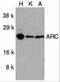 Nucleolar Protein 3 antibody, 2081, ProSci Inc, Western Blot image 