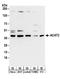 Sterol O-acyltransferase 2 antibody, A304-293A, Bethyl Labs, Western Blot image 