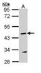 Argininosuccinate lyase antibody, orb69908, Biorbyt, Western Blot image 