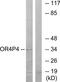 Olfactory Receptor Family 4 Subfamily P Member 4 antibody, TA315845, Origene, Western Blot image 