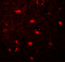 Microtubule-associated proteins 1A/1B light chain 3C antibody, 7583, ProSci, Immunofluorescence image 