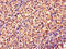 Dimethylarginine Dimethylaminohydrolase 2 antibody, CSB-PA006580LA01HU, Cusabio, Immunohistochemistry paraffin image 