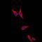Cadherin 1 antibody, orb213706, Biorbyt, Immunofluorescence image 