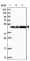 Ankyrin Repeat Domain 27 antibody, PA5-60111, Invitrogen Antibodies, Western Blot image 