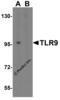 Toll Like Receptor 9 antibody, 3739, ProSci Inc, Western Blot image 