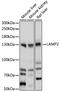 Lysosomal Associated Membrane Protein 2 antibody, 15-324, ProSci, Western Blot image 