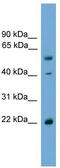 WW Domain Binding Protein 4 antibody, TA340157, Origene, Western Blot image 