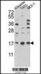 Creatine Kinase B antibody, orb73963, Biorbyt, Western Blot image 