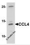 C-C Motif Chemokine Ligand 4 antibody, 7227, ProSci, Western Blot image 
