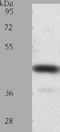 Sst2 antibody, TA321271, Origene, Western Blot image 