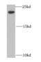 Interleukin-21 antibody, FNab04251, FineTest, Western Blot image 