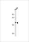 NADH:Ubiquinone Oxidoreductase Subunit B10 antibody, 61-006, ProSci, Western Blot image 