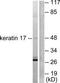 K17 antibody, TA314142, Origene, Western Blot image 