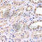 RTKN antibody, A6732, ABclonal Technology, Immunohistochemistry paraffin image 