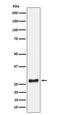 U2 small nuclear ribonucleoprotein A antibody, M10655, Boster Biological Technology, Western Blot image 