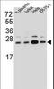Signal Sequence Receptor Subunit 2 antibody, LS-C161519, Lifespan Biosciences, Western Blot image 