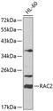 Rac Family Small GTPase 2 antibody, 14-009, ProSci, Western Blot image 